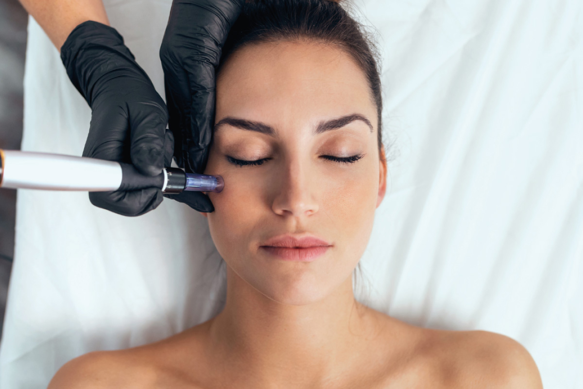 Dermapen-Facial